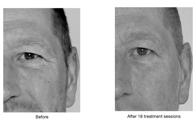 岐阜の美容院 ASHc-Lover ボディケア写真